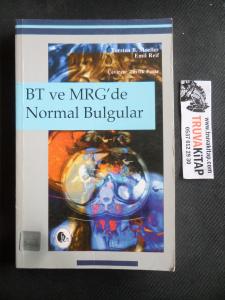 BT ve MRG'de Normal Bulgular