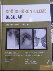Göğüs Görüntüleme Olguları