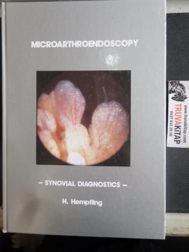 Microarthroendoscopy Synovial Diagnostics