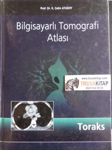 Bilgisayarlı Tomografi Atlası