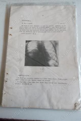 Eski Tıp Kitabı Sahifeleri