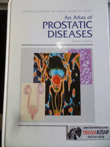 An Atlas Of Prostatic Diseases